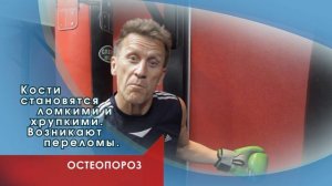 Остеопороз