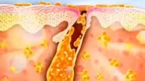 Демодекс Ру самый большой ассортимент средств от демодекоза www demodex ru