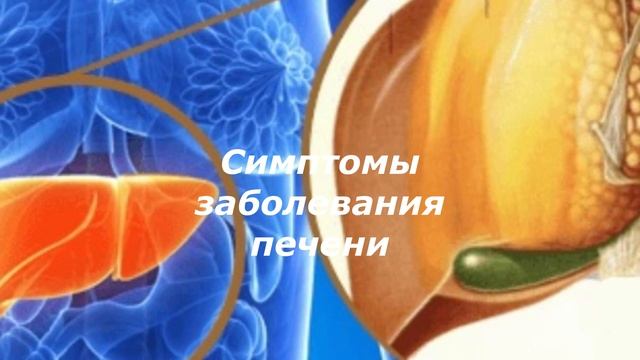ПЕЧЕНЬ. СИМПТОМЫ ЗАБОЛЕВАНИЯ ПЕЧЕНИ.  ВИРУСНЫЕ ГИПАТИТЫ. ЗДОРОВАЯ ЖИЗНЬ.