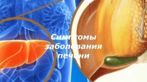 ПЕЧЕНЬ. СИМПТОМЫ ЗАБОЛЕВАНИЯ ПЕЧЕНИ. ВИРУСНЫЕ ГИПАТИТЫ. ЗДОРОВАЯ ЖИЗНЬ.