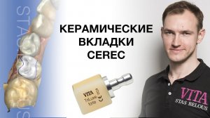 Лечение кариеса вкладками CEREC Стас Белоус Стоматолог Vita Zahnfabrik #vitazahnfabrik