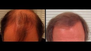 Как сделать маску из лука для волос