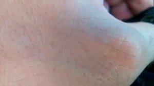 Om642 звук из маслозаливной горловины после замены цепи ГРМ. Видео 2