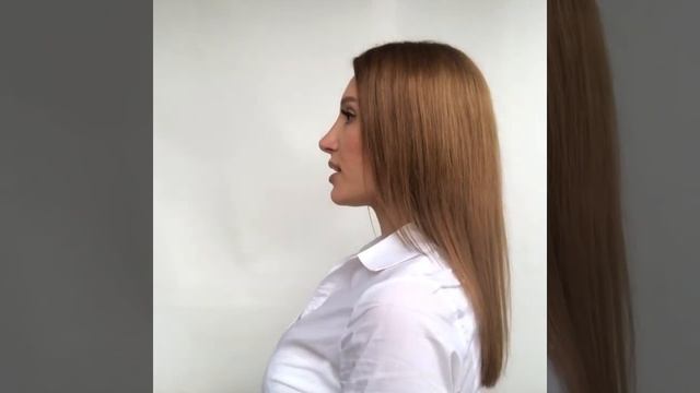 10 месяцев после ринопластики. Вячеслав Витальевич лучший! смотреть онлайн