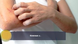 Дегтярное мыло: польза дегтярного мыла для кожи и волос