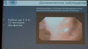 07 Бужирование доброкачественных стенозов пищевода у детей  Инородные тела и ГЭРБ как причина ресте