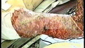 Госпиталь Вишневского