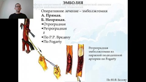 Лекция "Хирургия сосудов – история, задачи, успехи и перспективы"