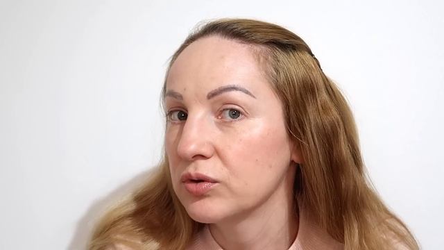 БОТОКС 35+ КОЛОТЬ ИЛИ НЕТ! ПОСЛЕДСТВИЯ МОЙ ОПЫТ!