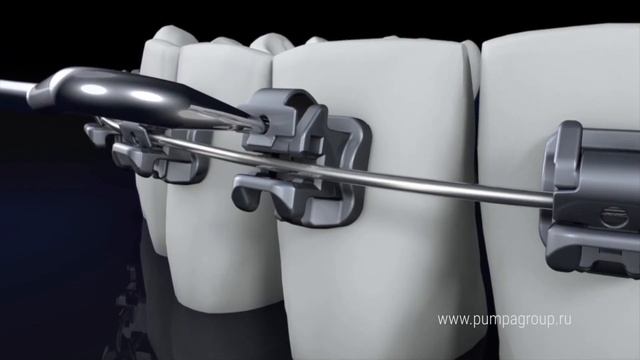 BioQuick — замена клипсы смотреть онлайн