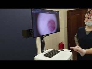 Картирование кожи на FotoFinder - паспорт кожи