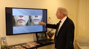 Facial Aging in Women - Facial Fillers Lexington Kentucky