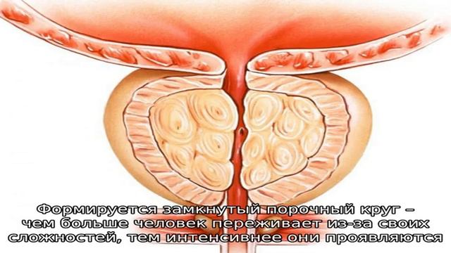 Если не лечить простатит:осложнения, последствия и профилактика