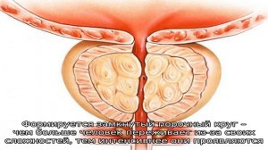 Если не лечить простатит:осложнения, последствия и профилактика