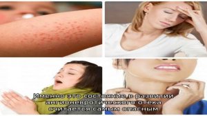 Что такое отек Квинке