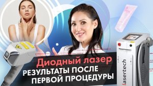 Какие результаты дает диодный лазер после первой процедуры? LASERTECH