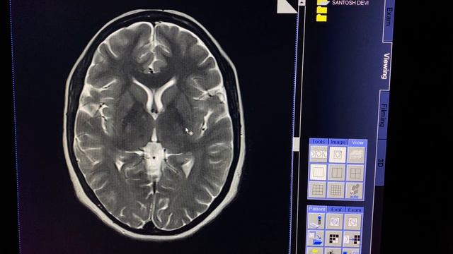 MRI BRAIN SCAN को कैसे देखें #brain #reading смотреть онлайн