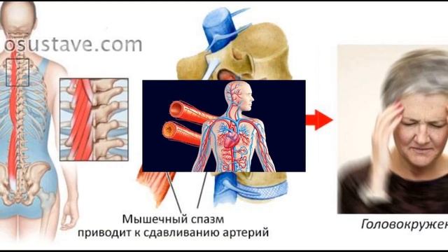 Что Будет с вашим Телом, если Висеть на Турнике ? Польза и вред турника для позвоночника