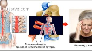Что Будет с вашим Телом, если Висеть на Турнике ? Польза и вред турника для позвоночника