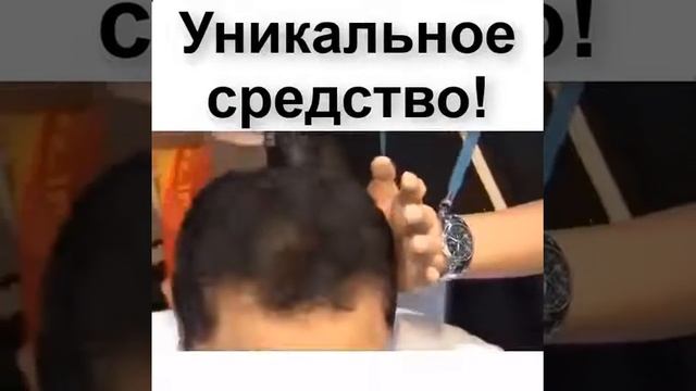 лук от выпадения волос смотреть онлайн