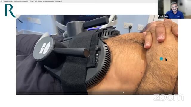 HIFEM For Muscle Sculpting & Fat Reduction