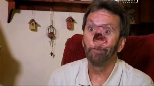 Мужчина без носа   Моя Ужасная История