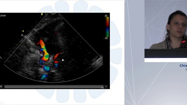 TCD and ultrasound in TBI Chiara Robba  ESICM 22 Tr&TBI