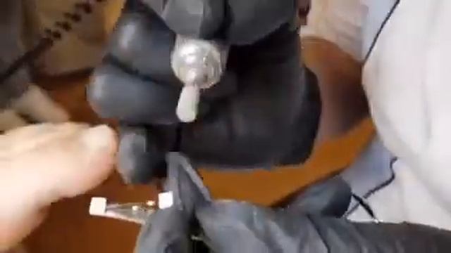 Ортониксия.  Скоба COMBI NiTi