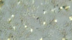 кристаллы мочевой кислоты в осадке мочи