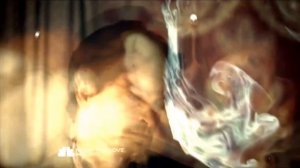 Hannibal | Madness | Will Graham