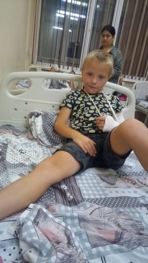 Я сломал руку