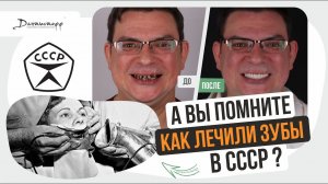 Вы помните КАК лечили зубы в СССР ? → #имплантациязубов #зубныепротезы