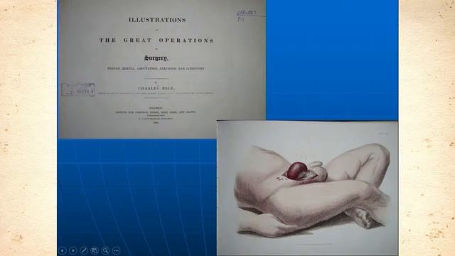 Хирургические эссе в изобразительном искусстве