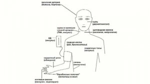 Методика неврологического осмотра. Часть 1.