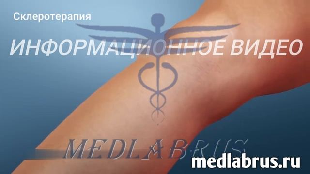 Варикозное расширение вен-лечение!