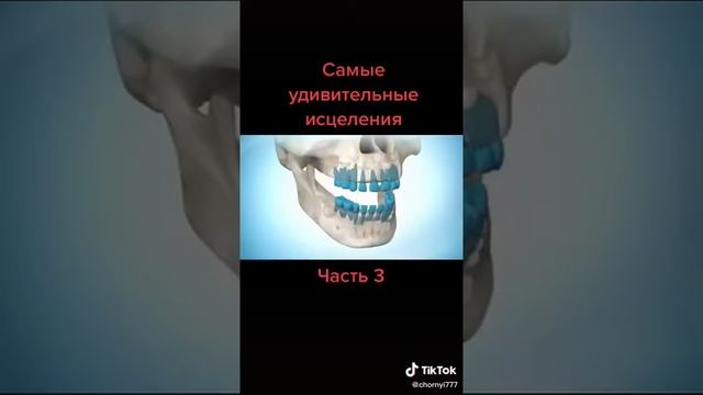 Ребенок отрастил себе ногу. Восстановление конечностей