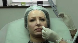 Контурная пластика - канюля - минимальным количеством максимальный результат
