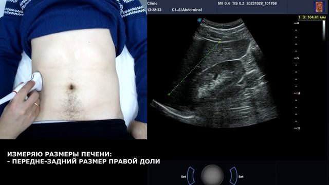 Пишем ПРОТОКОЛ УЗИ органов брюшной полости ВМЕСТЕ
