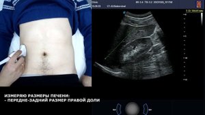 Пишем ПРОТОКОЛ УЗИ органов брюшной полости ВМЕСТЕ