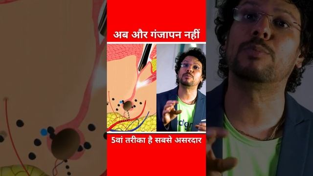 Hair Loss  Hair Fall  Hair Damage  Hair Regrowth  PRP  Minoxidil  Hair Transplant  Fue  Ado