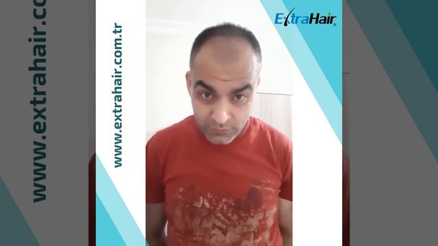Extra Hair Yeşil serumu смотреть онлайн