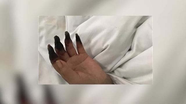 Через 2 дня после уборки, женщина начала замечать, что ее пальцы чернеют смотреть онлайн