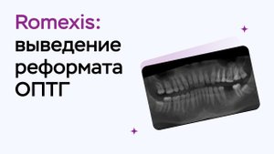 Возможности программы Romexis Viewer: выведение реформата ОПТГ