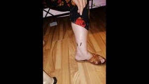 ПРИМЕНЕНИЕ ПИЯВОК ПО РАЗМЕРАМ /КАК СТАВИТЬ ПИЯВКИ / ГИРУДОТЕРАПИЯ / ПИЯВКИ / МЕДИЦИНСКИЕ ПИЯВКИ