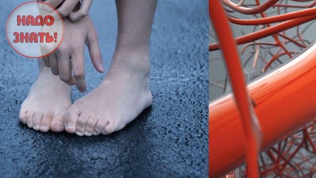 Почему ноги холодные? смотреть онлайн