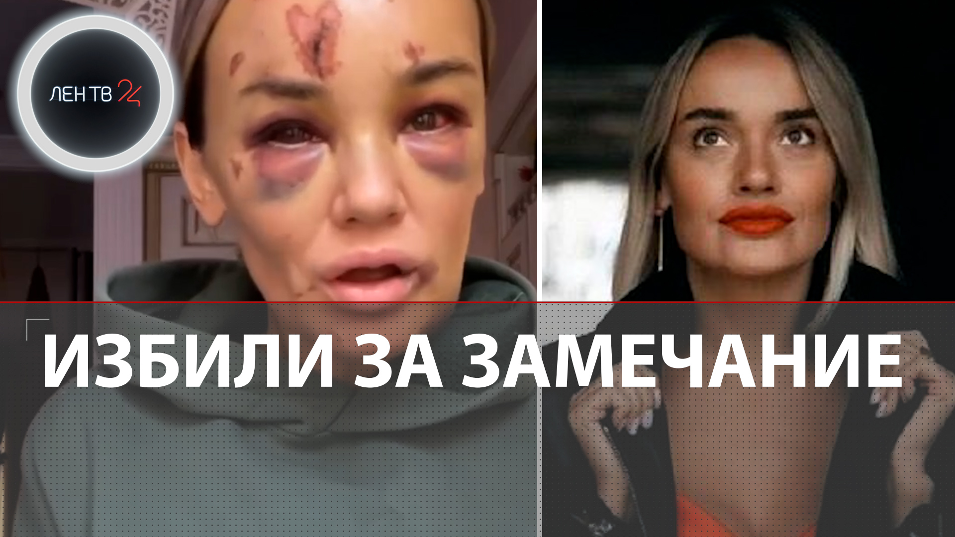 Анну Леонову жестоко избили из-за замечания | Нападение на мать троих детей попало на видео