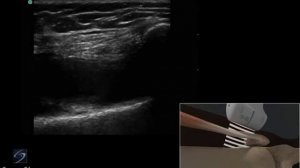 3D-пособие: инъекция в коленный сустав при медиальном доступе под ультразвуковым контролем