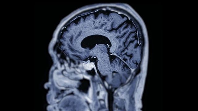 Разбираем самый популярный миф о человеческом мозге смотреть онлайн