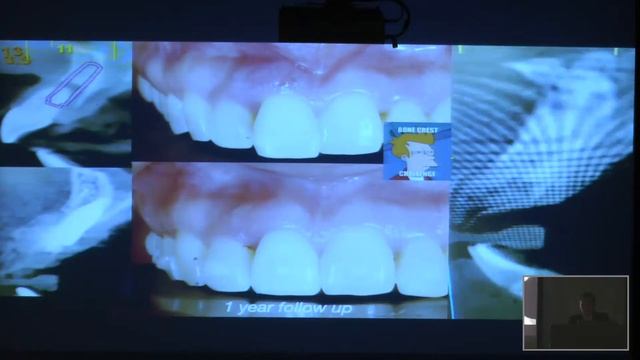 Congreso del Posgrado en Periodoncia por su XXX Aniversario смотреть онлайн