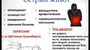 Обучающее видео. Острый живот. Основные положения и дифференциальная диагностика.